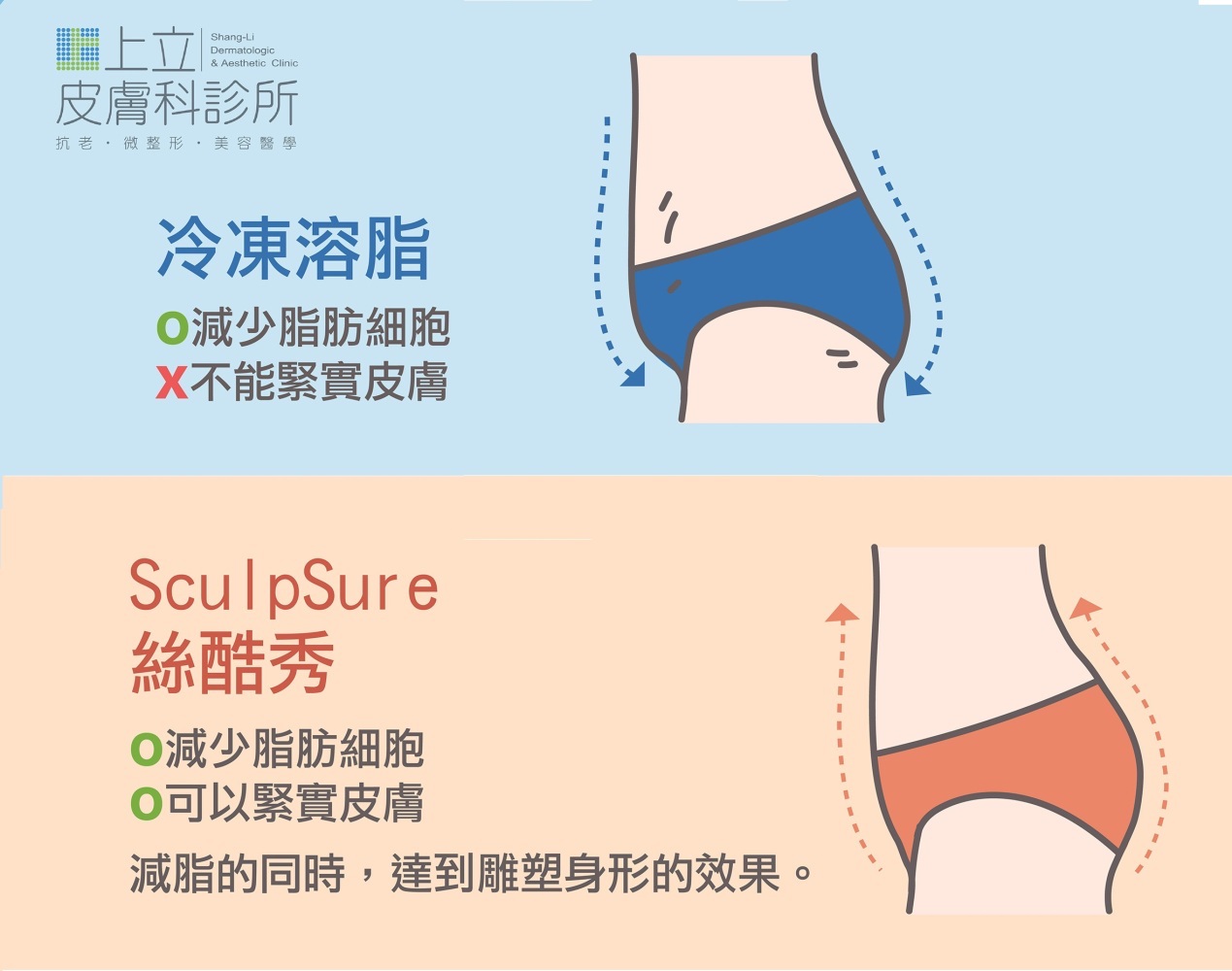 冷凍溶脂vsSculpsure絲酷秀