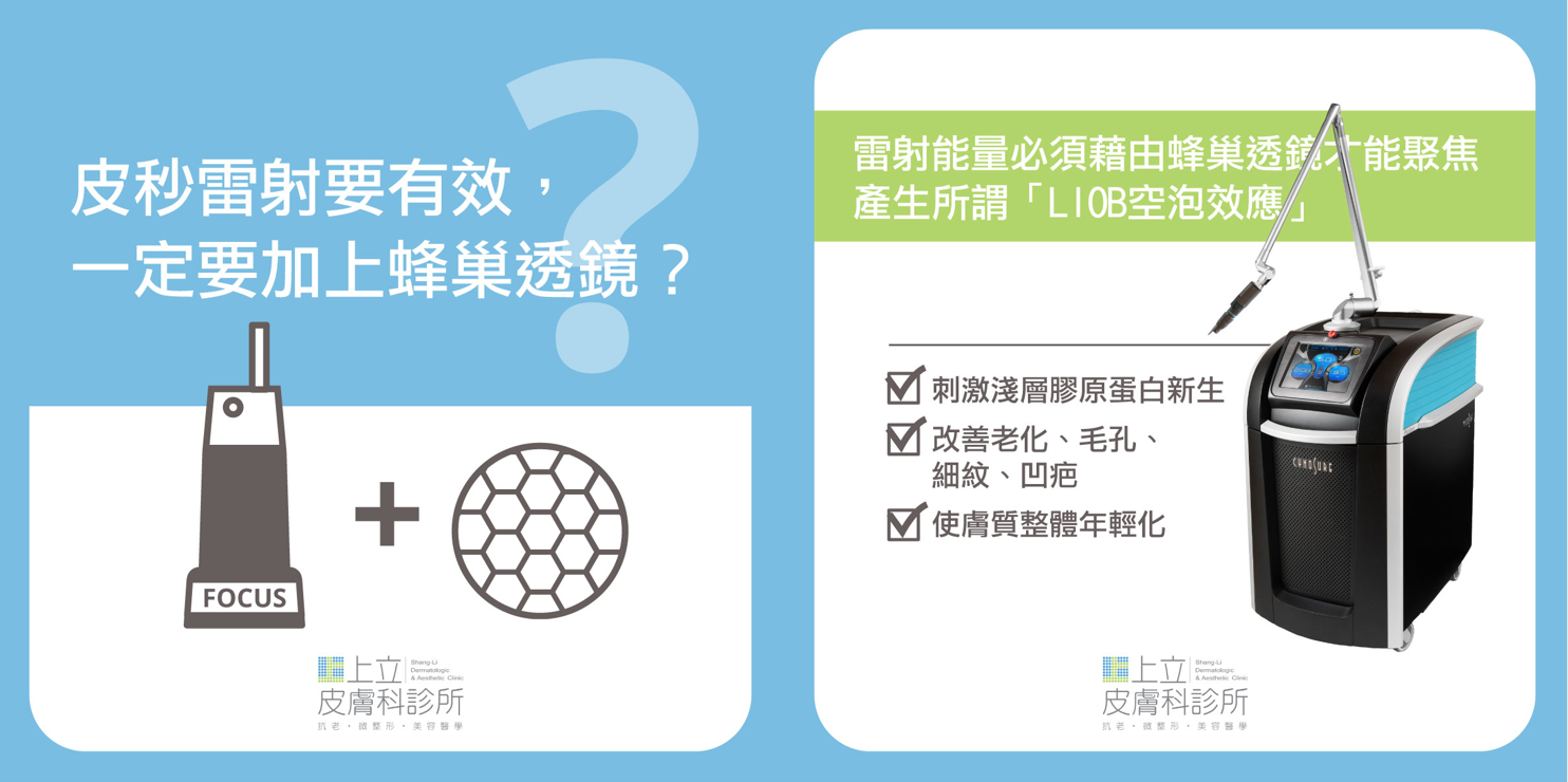 皮秒雷射加蜂巢透視