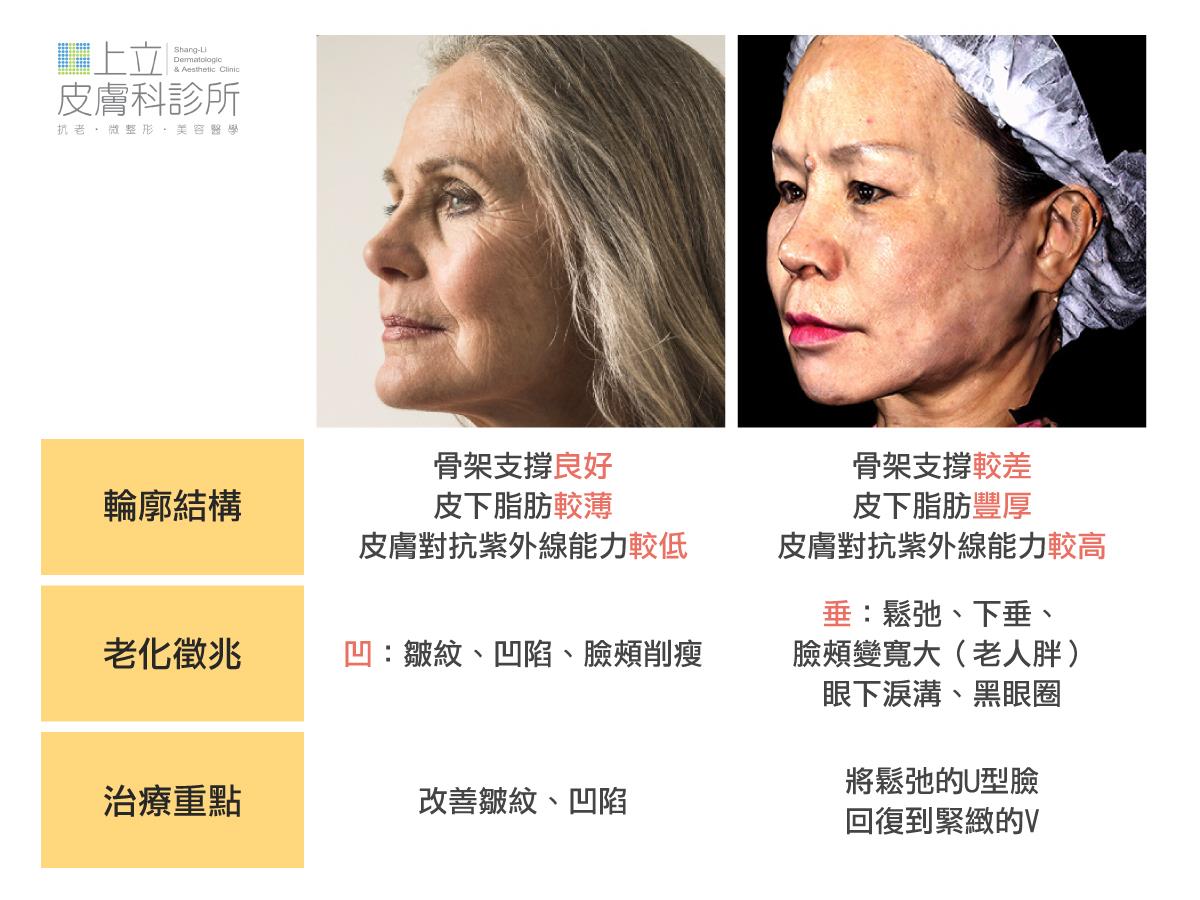 亞洲人與西方人的輪廓比較