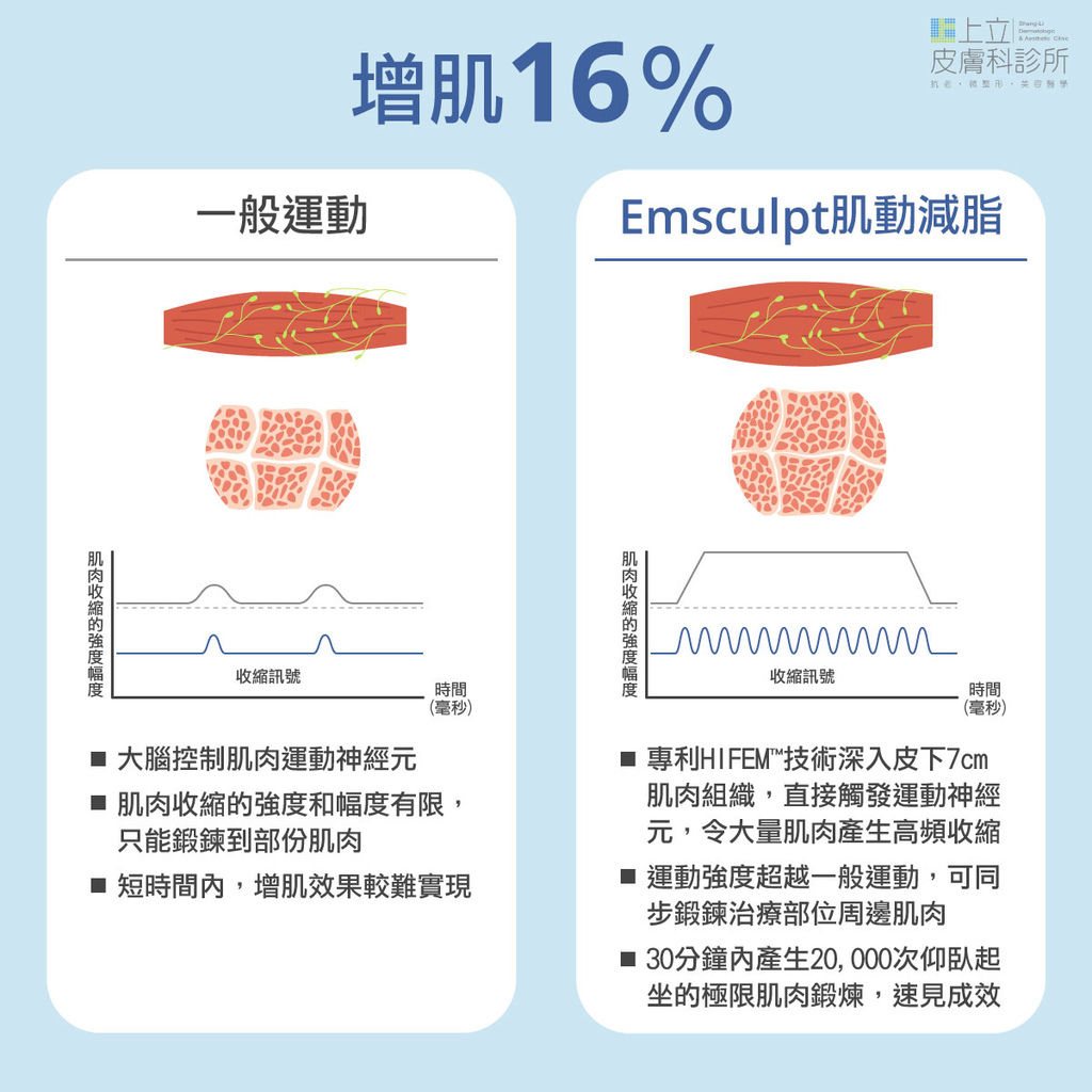 Emsculpt肌動減脂與一般運動的比較