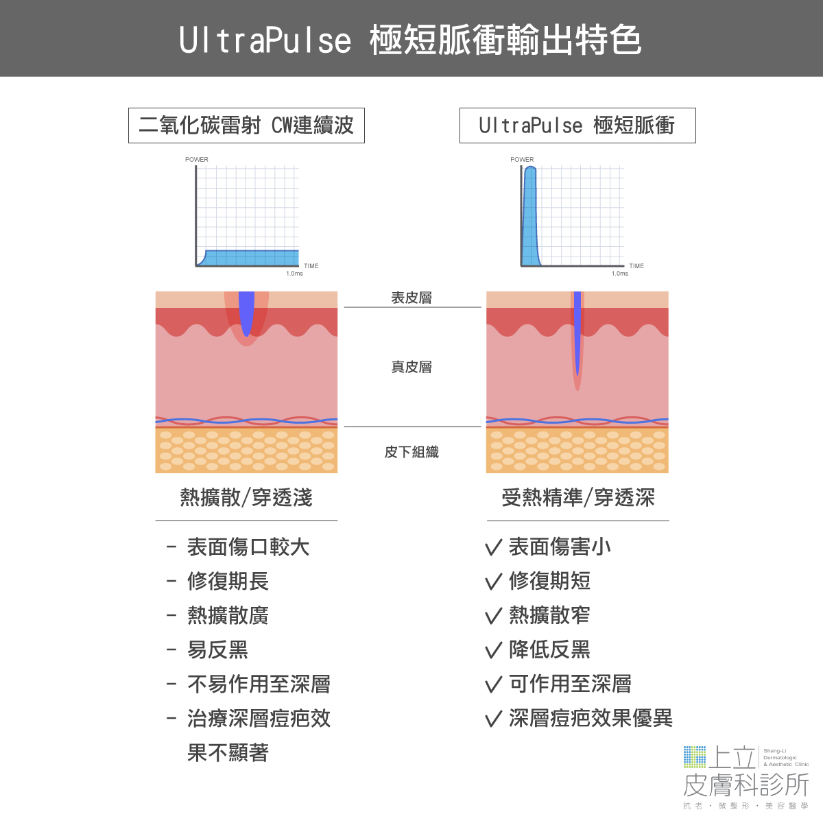 UltraPulse極速脈衝輸出特色
