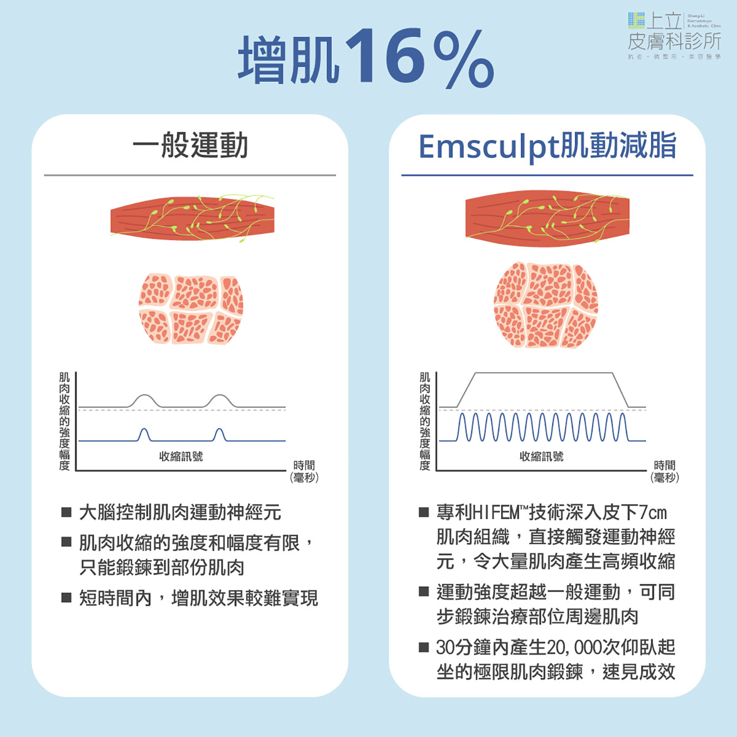 EMSCULPT肌動減脂增肌減脂的效果