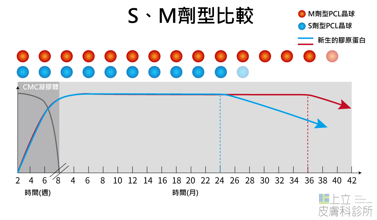 Ellanse洢蓮絲S劑型與M劑型效果比較