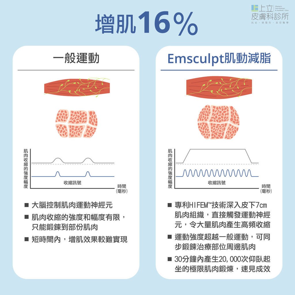 EMSCULPT治療過後，肌肉量增加16%