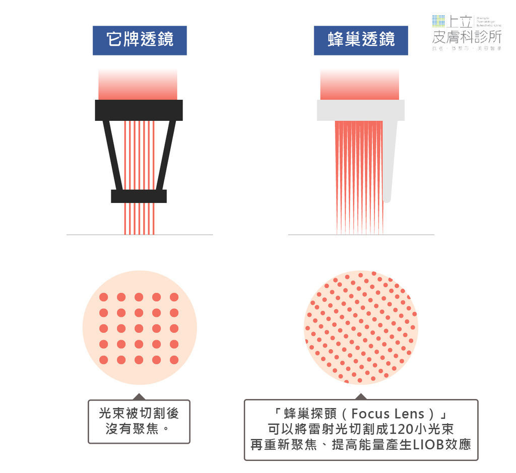 755皮秒雷射蜂巢透鏡與其他牌透鏡差異比較