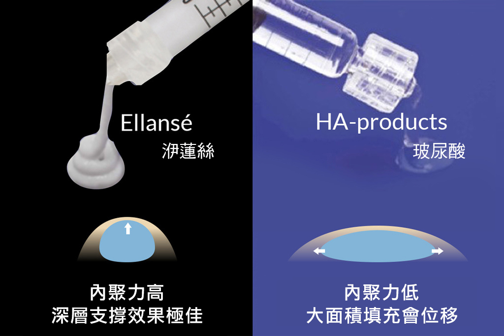 Ellans&eacute;洢蓮絲黏稠度、彈性較佳，用於深層支撐的效果卻很好。