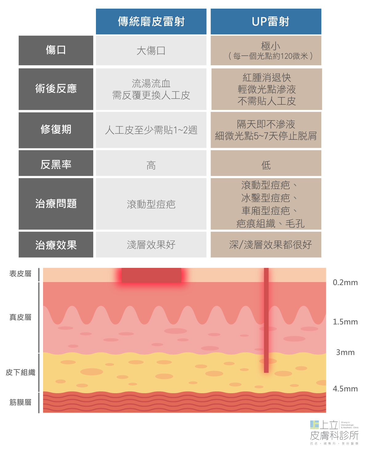 傳統磨皮雷射和UP雷射修復期和各種治療效果比較表