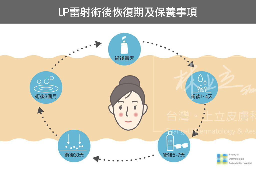 UP雷射術後保養時間軸及保養事項