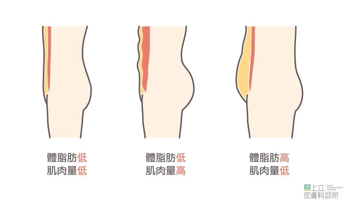 體脂肪低，肌肉量高；體脂肪低，肌肉量低；體脂肪高，肌肉量低三種體態的人