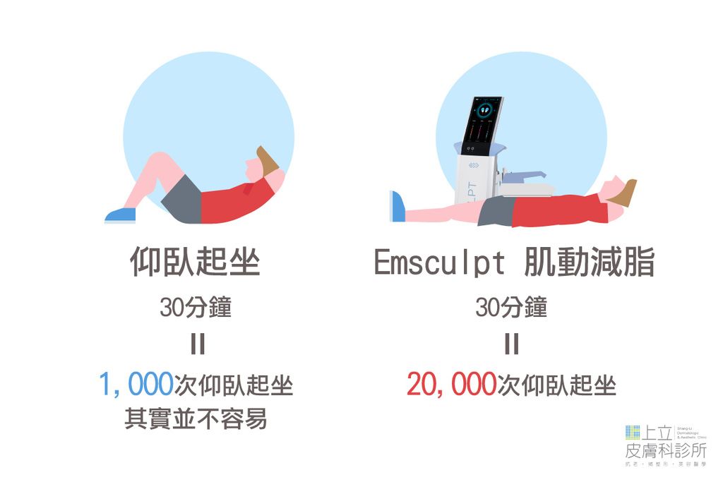 EMSCULPT肌動減脂（肌動翹臀）肌肉收縮，就像是身體做了20,000次的仰臥起坐