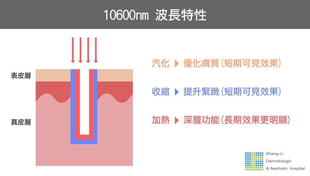 UP 雷射的 10600nm 波長，除了淺層優化膚質，同時熱能使地肌膚收縮，短期 可以感受到膚質細緻、淺層毛孔緊縮