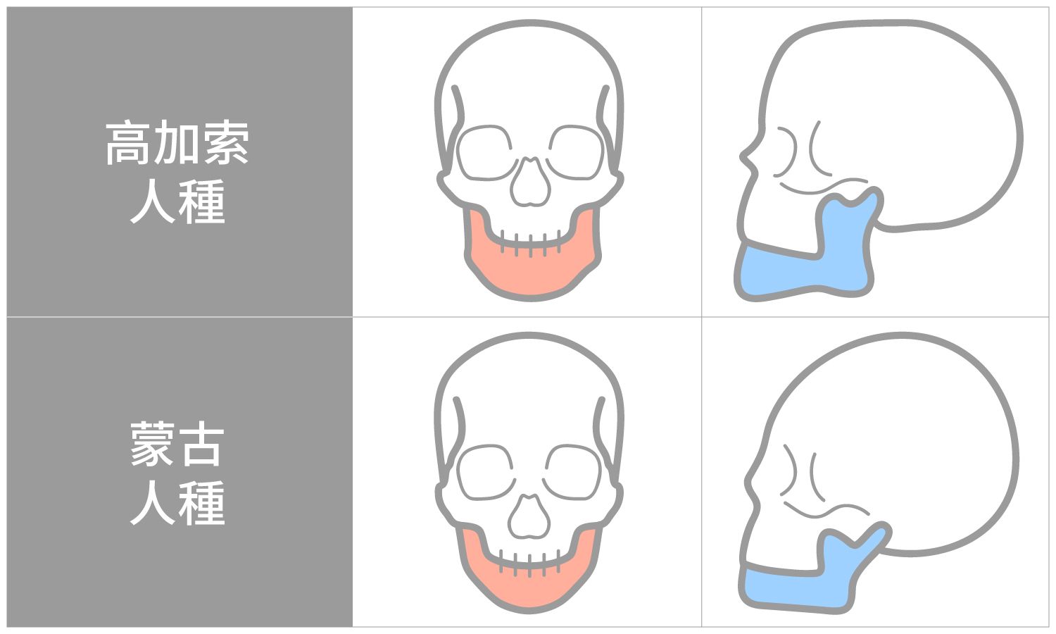 人種差異，先天下巴短，骨架支撐不足