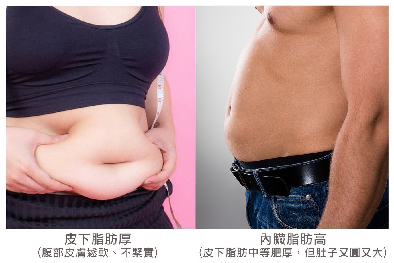 極少數的儀器可以達到降地內臟脂肪的效果而EMSCULPT肌動減脂正是其中之一
