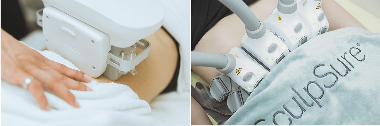 冷凍溶脂的大型吸取式探頭 VS SculpSure 絲酷秀非侵入式雷射溶脂的4個平貼式探頭