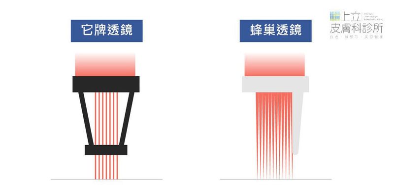 PicoSure皮秒雷射蜂巢透鏡與他牌透鏡不同