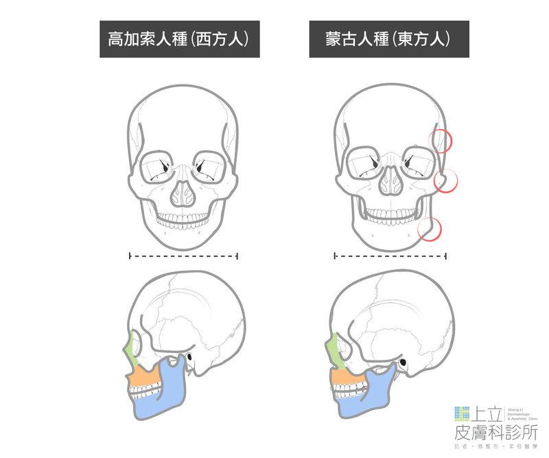 亞洲人天生骨架就比西方人更扁、更塌一些，甚至經常會有下巴後縮
