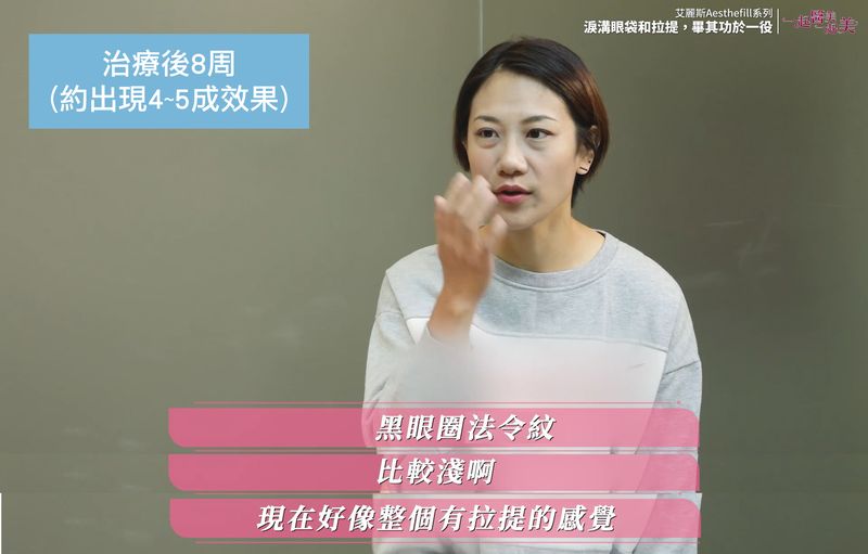 Ada在治療後8周證實黑眼圈法令紋都比較淺，整個臉有拉提效果