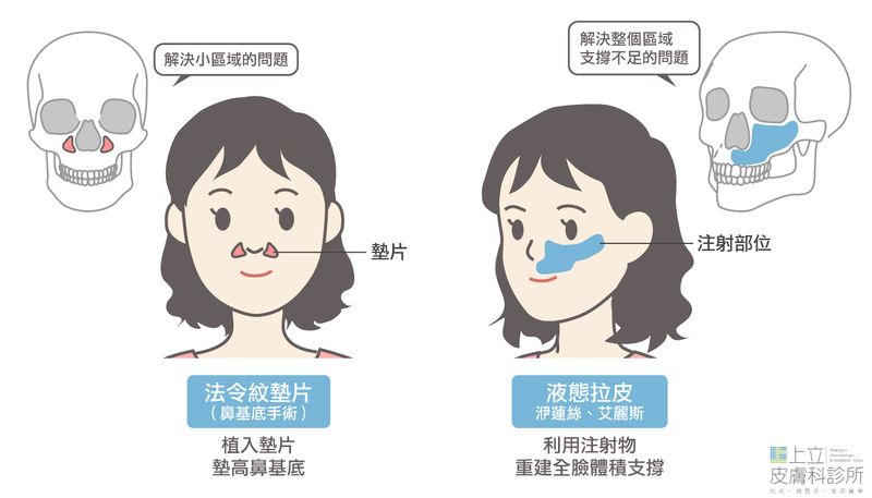 法令紋墊片，無法改善全臉骨架流失，洢蓮絲、艾麗斯都能刺激皮膚新生膠原蛋白，恢復皮膚的彈性和飽滿度。