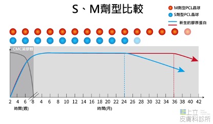 洢蓮絲S型和Ｍ型比較