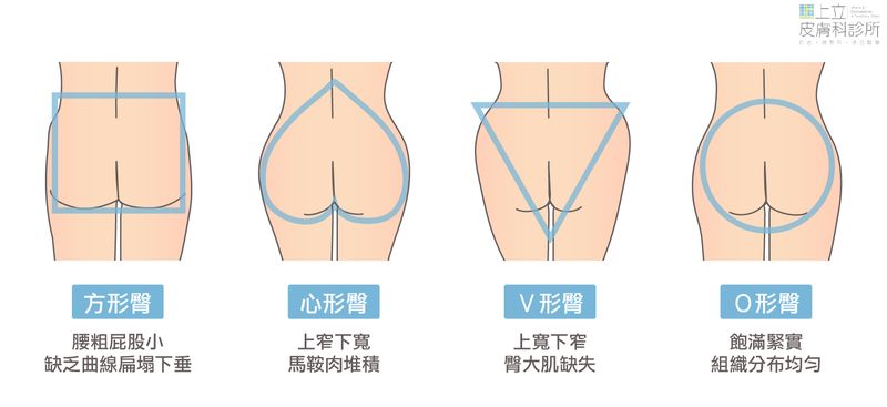 臀部形狀則可以大致歸類為方形臀、心型臀、Ｖ型臀、圓形臀