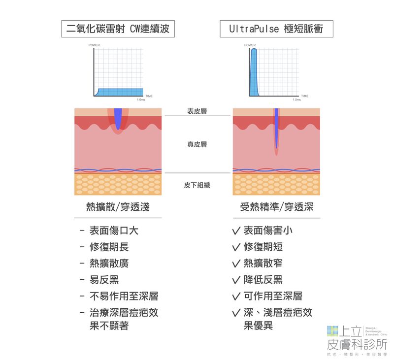 UltraPulse極速脈衝輸出特色