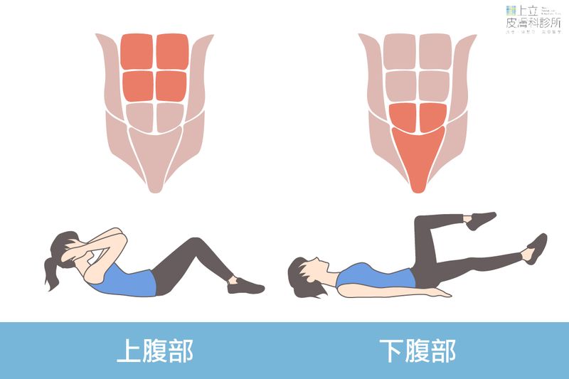 EMSCULPT肌動減脂上腹部和下腹部肌群多而複雜，需透過不同的姿勢進行訓練