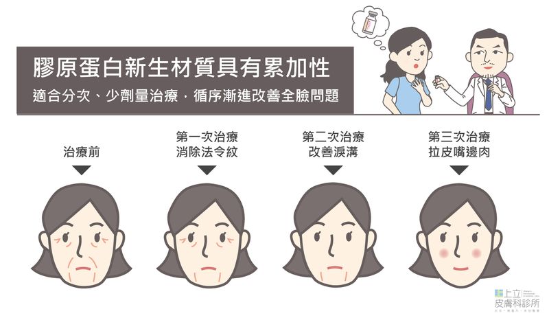 AestheFill艾麗斯治療膠原蛋白新生具有累加性