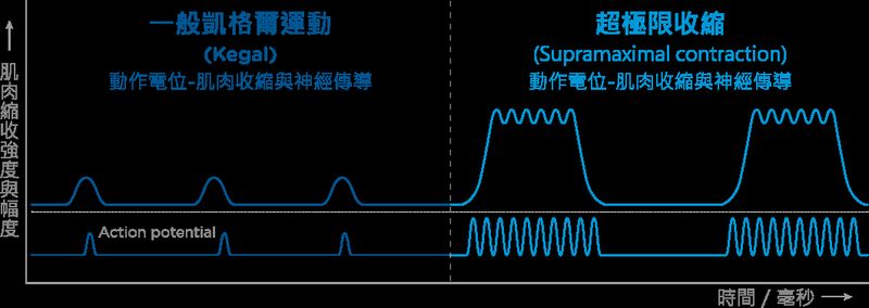 G動椅透過高聚焦電磁科技，可以創造一般運動難以達到一般凱格爾運動難以達到的高頻率、高強度鍛鍊效果。