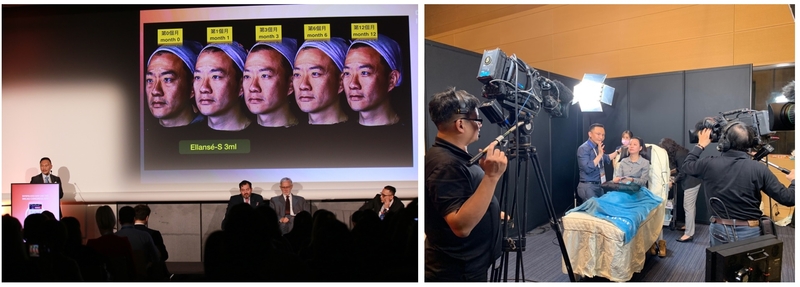林上立醫師發表多場演說，包含聚己內酯填充物的不良反應之成因及預防、洢蓮絲ELLANS&Eacute;於臉部治療的2cc漸進治療策略、埋線和填充物的抗老合併治療、聚己內酯於頸部老化治療的運用等