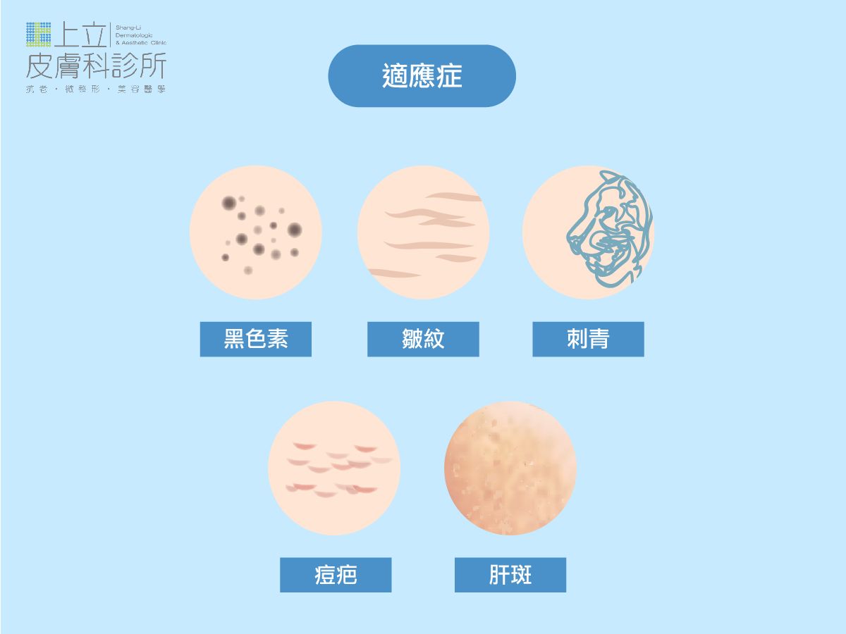 皮秒雷射適應症，除黑色素、除皺紋、除刺青、除痘疤、除肝斑