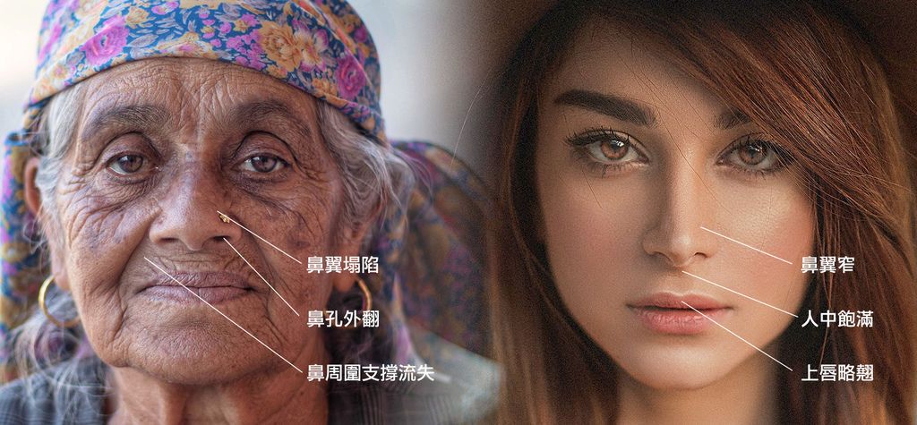 老化嘴巴四周的支撐流失，造成鼻子和唇形都出現變化。