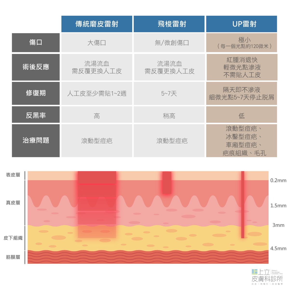 傳統磨皮雷射、飛梭雷射、UP雷射各項比較和治療深度
