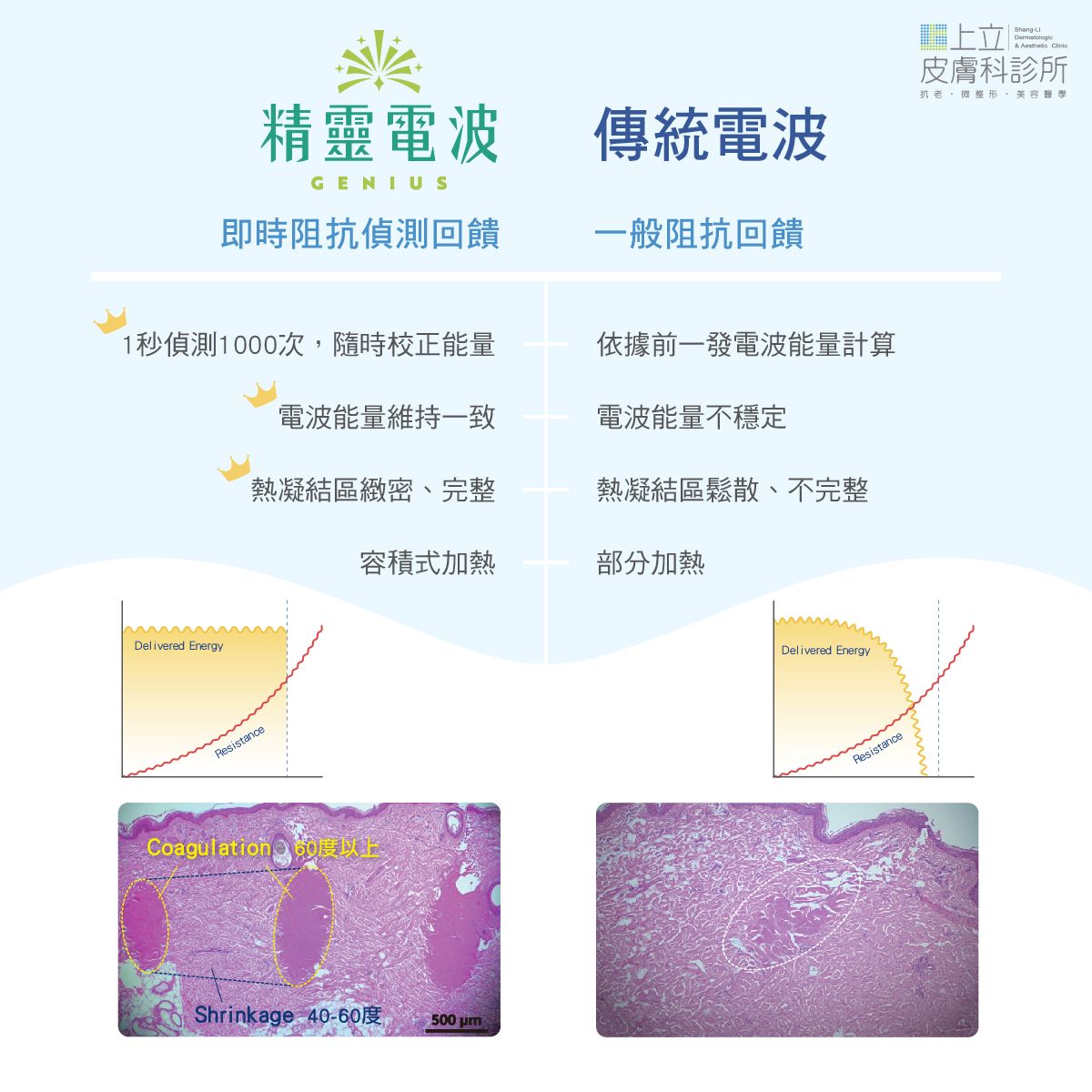 精靈電波與傳統電波比較，隨時校正能量，讓電波加熱不受阻抗影響
