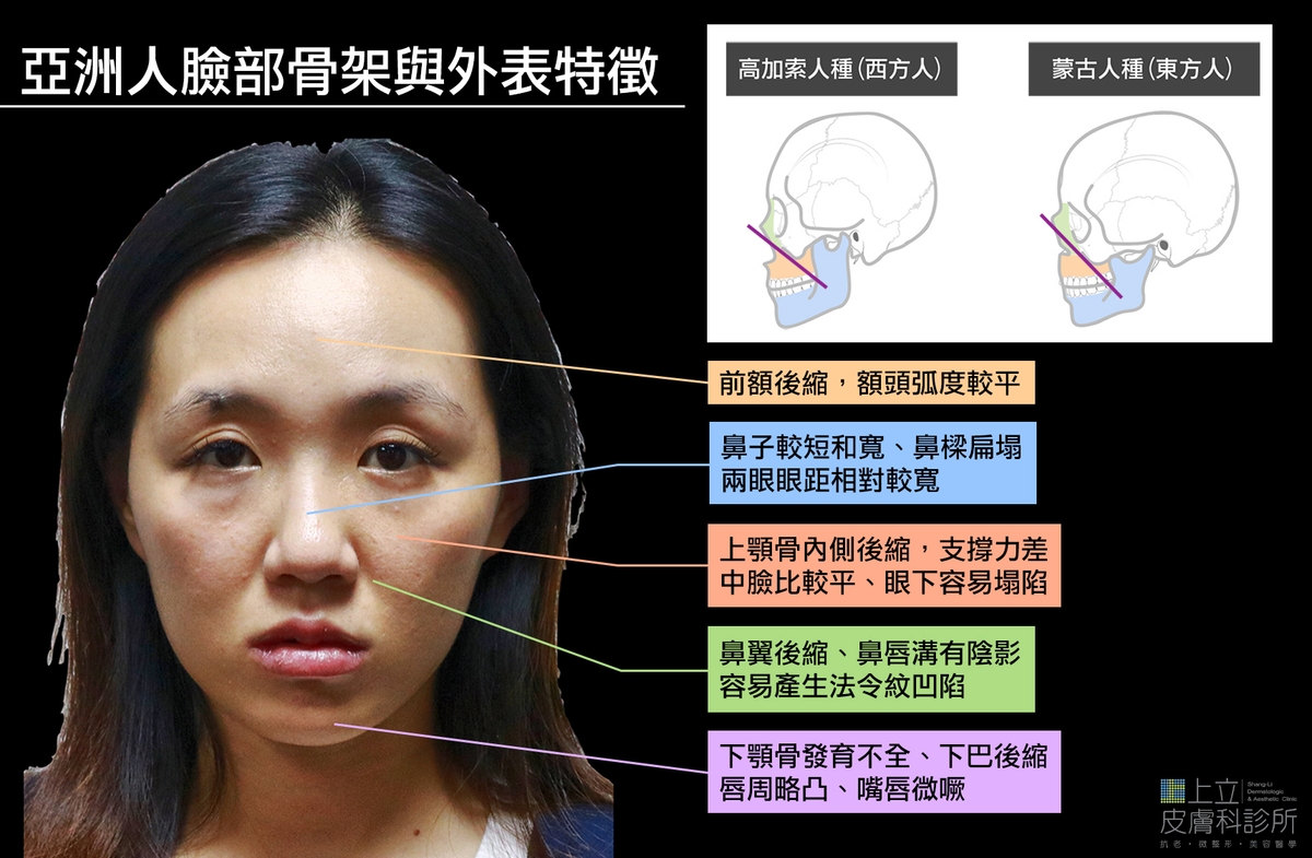 亞洲人更容易出現法令紋，形成原因多半來自於凹陷及皺折。