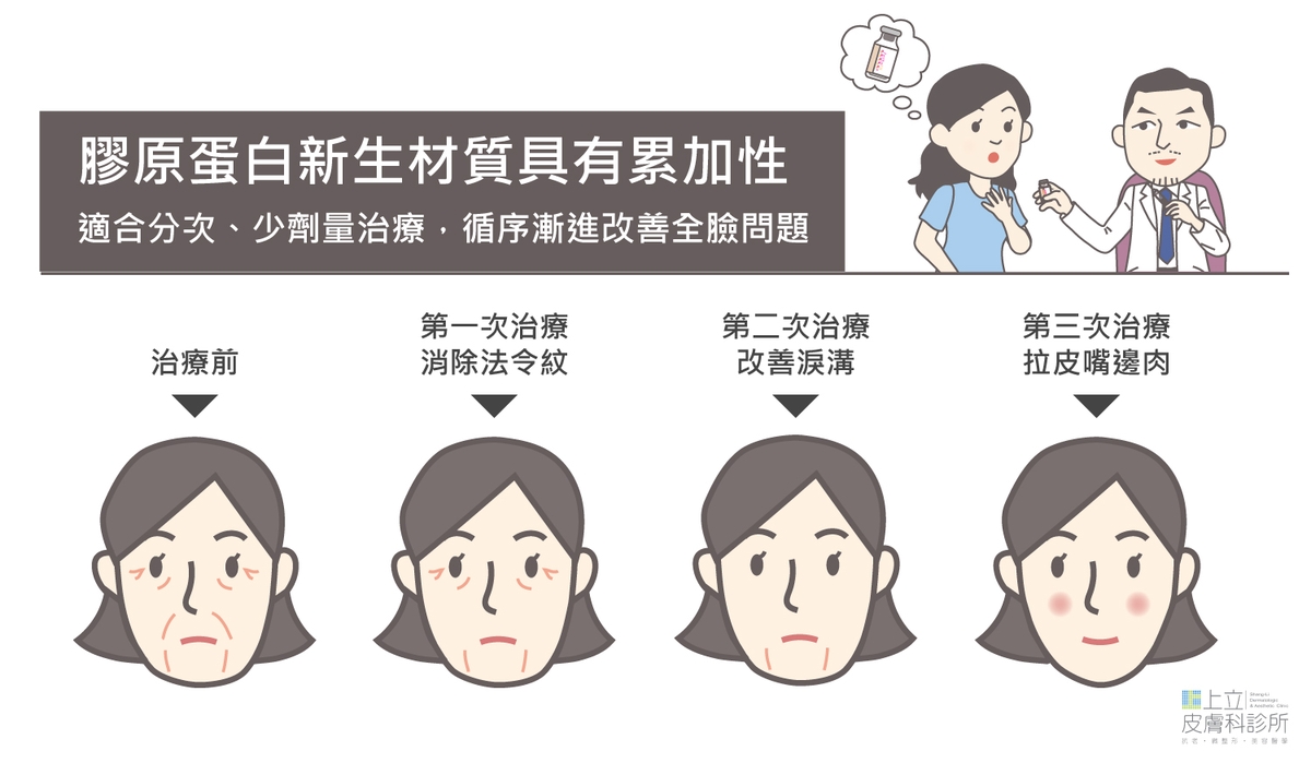 AestheFill艾麗斯、ELLANS&Eacute;洢蓮絲等膠原蛋白新生材質的累加性優勢