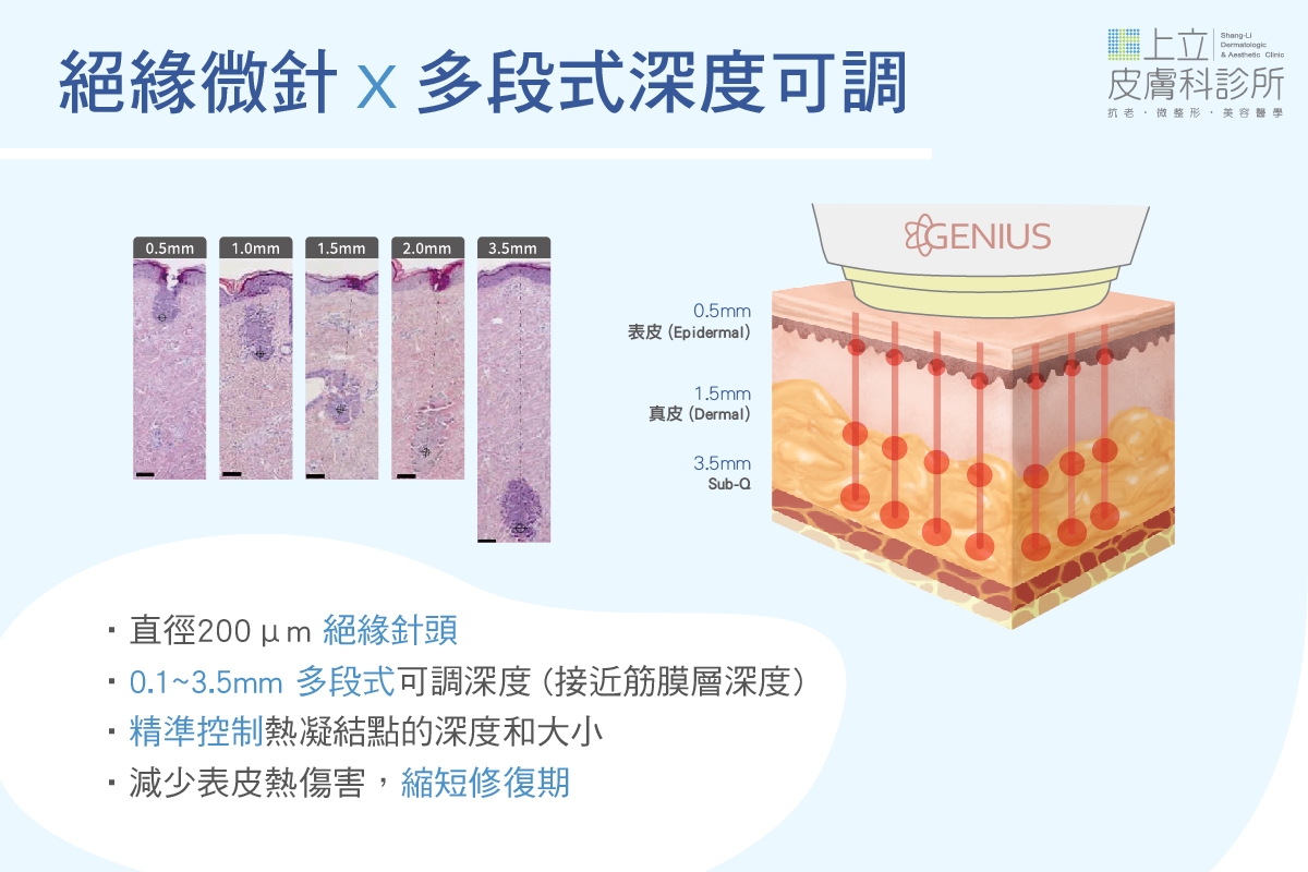 精靈電波絕緣微針深度可調，針對不同皮膚問題給予治療