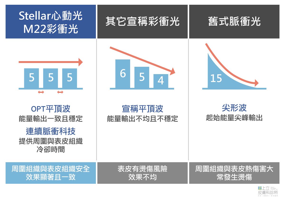 Stellar心動光新一代彩衝光與脈衝光比較