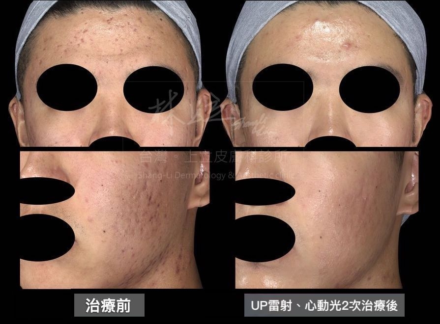 Stellar心動光可以提供良好的改善泛紅、膚質調理、緩解發炎反應