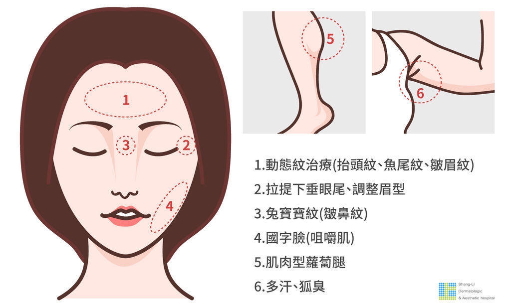 醫美入門懶人包經典入門款：肉毒桿菌素