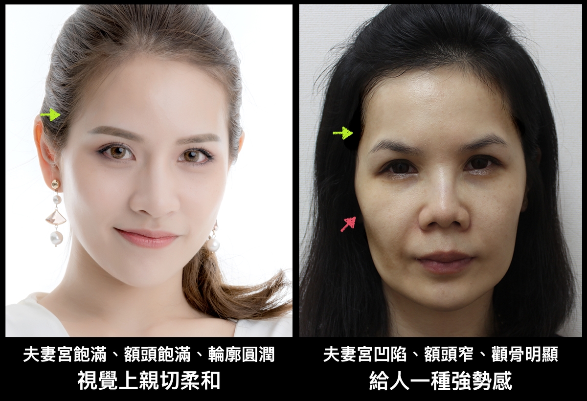 透過髮型來修飾凹陷的夫妻宮，飽滿度對於全臉輪廓都有很大影響。