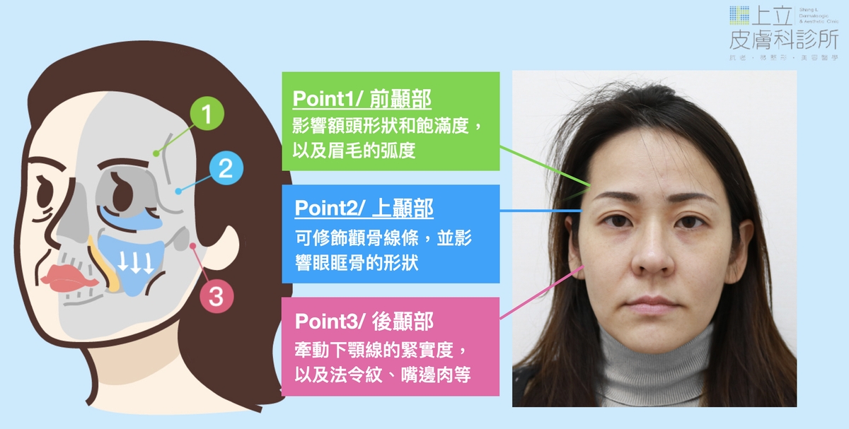 顳部流失的位置和深度不同，對夫妻宮帶來不同程度的影響