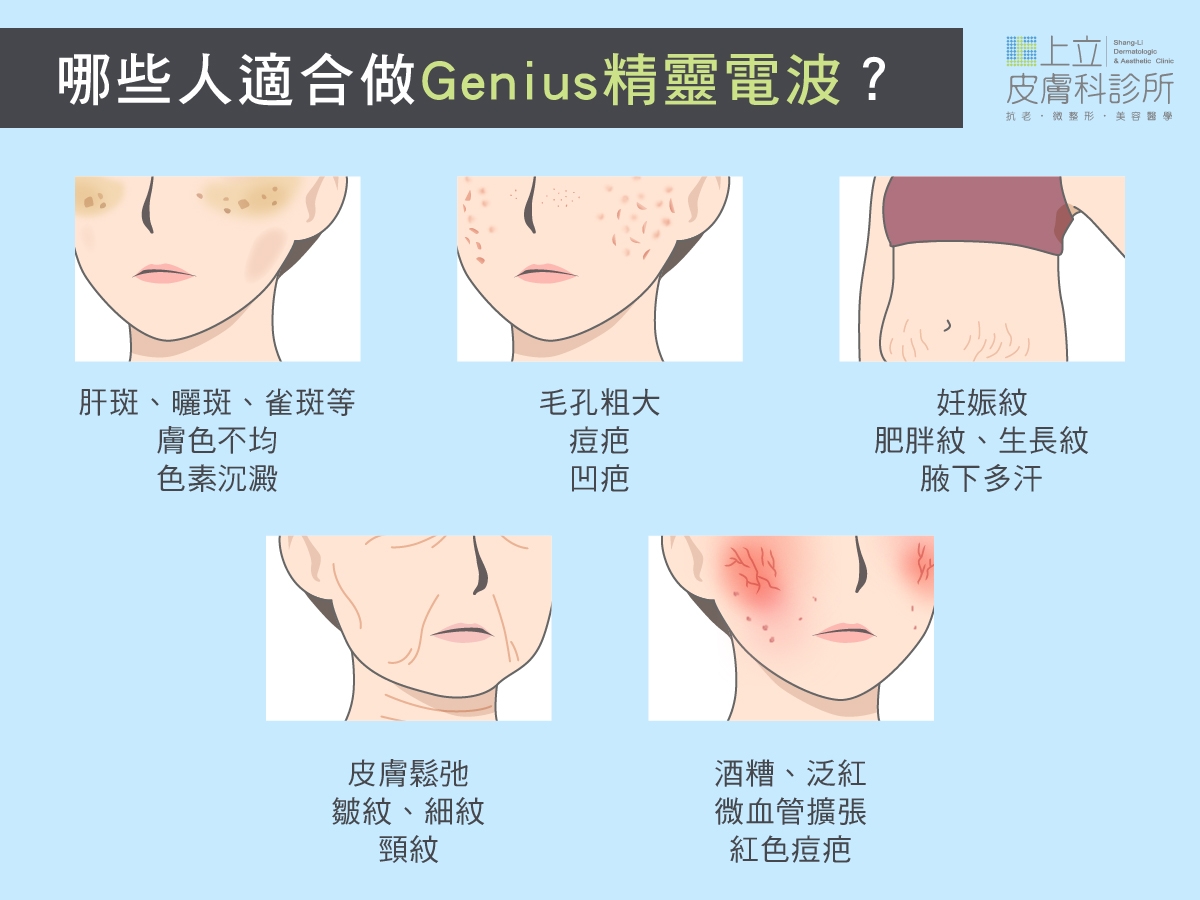 Genius精靈電波根據不同人遇到的皮膚問題，有不同治療目標