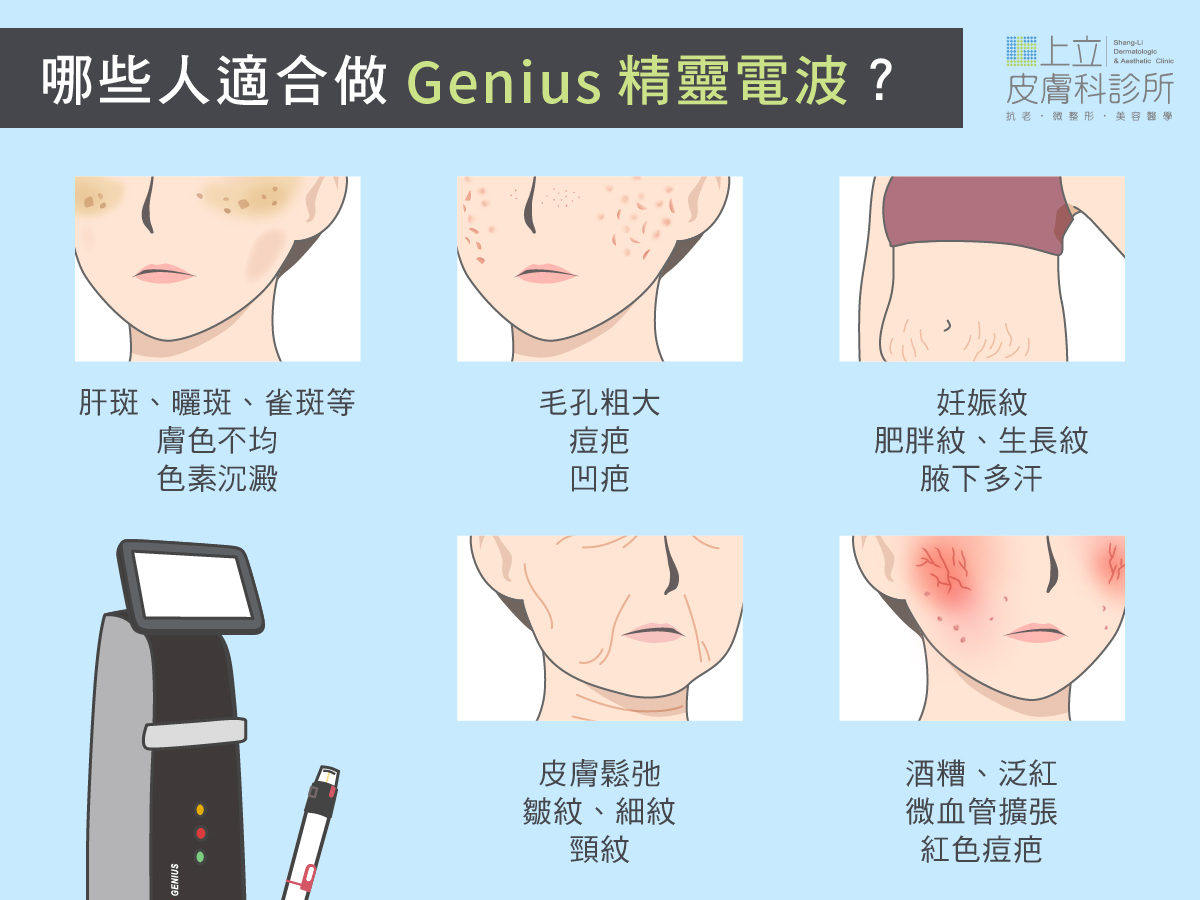 Genius精靈電波，達到改善毛孔、紋路、青春痘凹疤等效果。