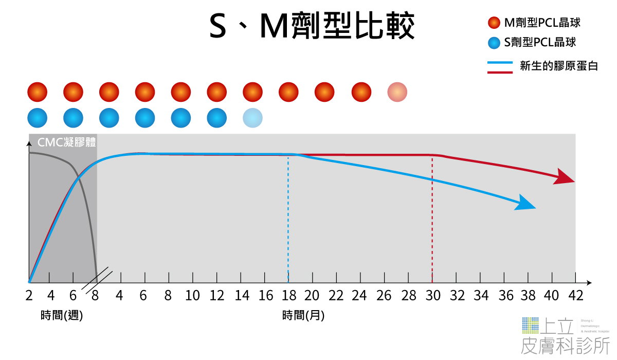 ELLANS&Eacute;洢蓮絲S型與M型的比較