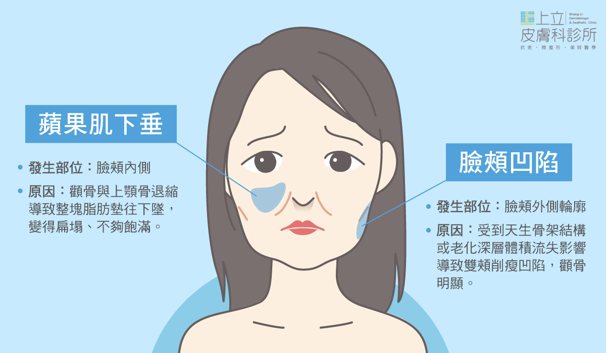 「臉頰」和「蘋果肌」其實位於臉部的不同位置，並且在老化的表現上，它們也呈現不同的狀態