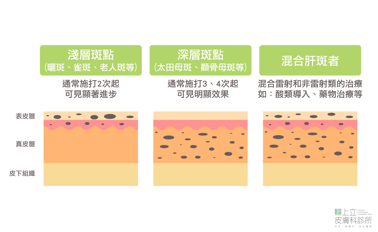 不同班點施打狀況圖解
