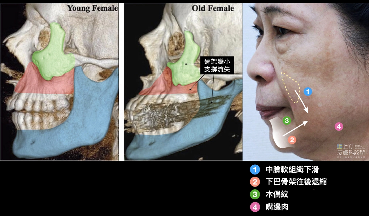 治療部位解說