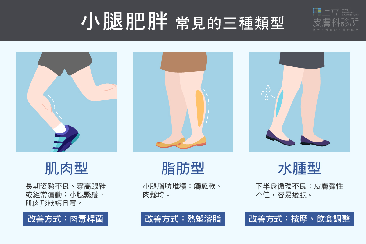 小腿粗壯、蘿蔔腿分三種類型