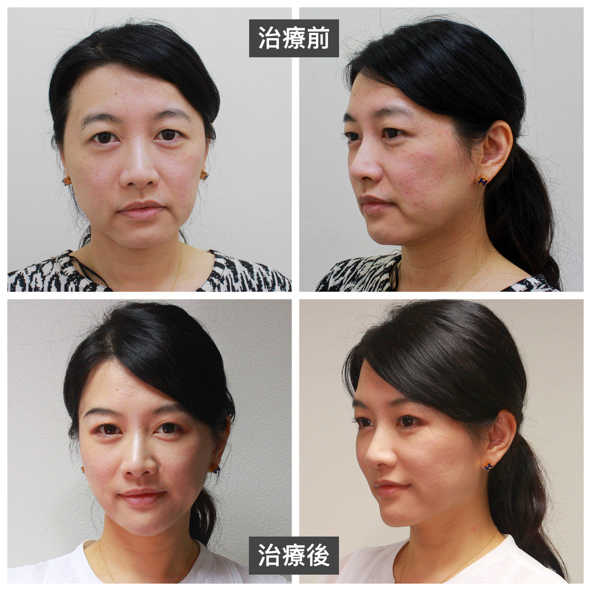 ELLANS&Eacute; 洢蓮絲型錄的封面案例