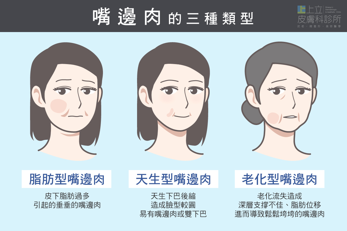 嘴邊肉的三種類型